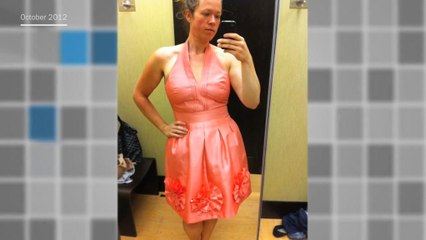 Photos of woman&apos;s 160-pound weight loss go viral