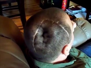 L'homme capable de gonfler et dégonfler sa tête