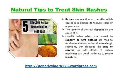 Natural Tips to Treat Skin Rashes