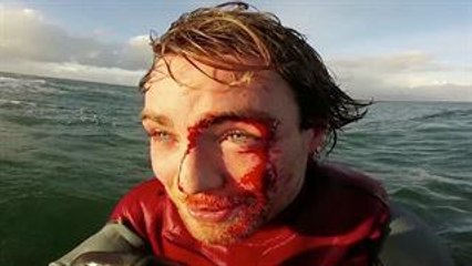 Messed Up At Mullaghmore