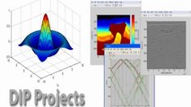 2015 DIP Project output - Dip Projects in Matlab
