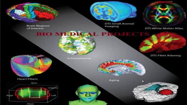 Bio medical project output - Bio Medical Engineering Projects Ideas