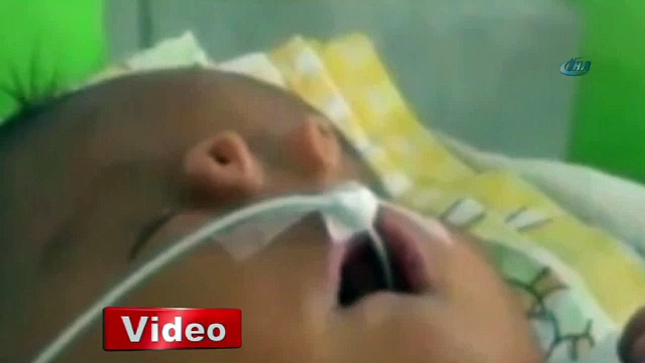 Dünyanın en farklı bebek burnu
