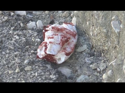 Napoli - 16enne accoltellato mentre ragazzi escono da scuola (30.09.15)