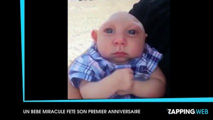 Malgré les pronostics des médecins, un bébé atteint d'une rare malformation fête son premier anniversaire