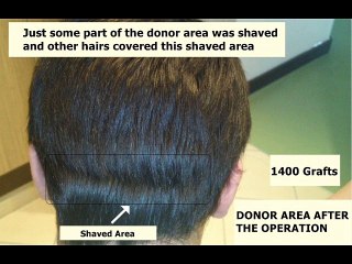 Dr Hakan Doganay Reviews results forum