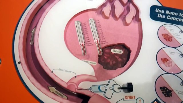 Model of Nano Gold Particles attacting Cancer