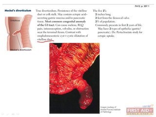 Gastrointestinal Pathology Part 3