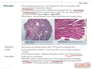 Gastrointestinal Pathology Part 4