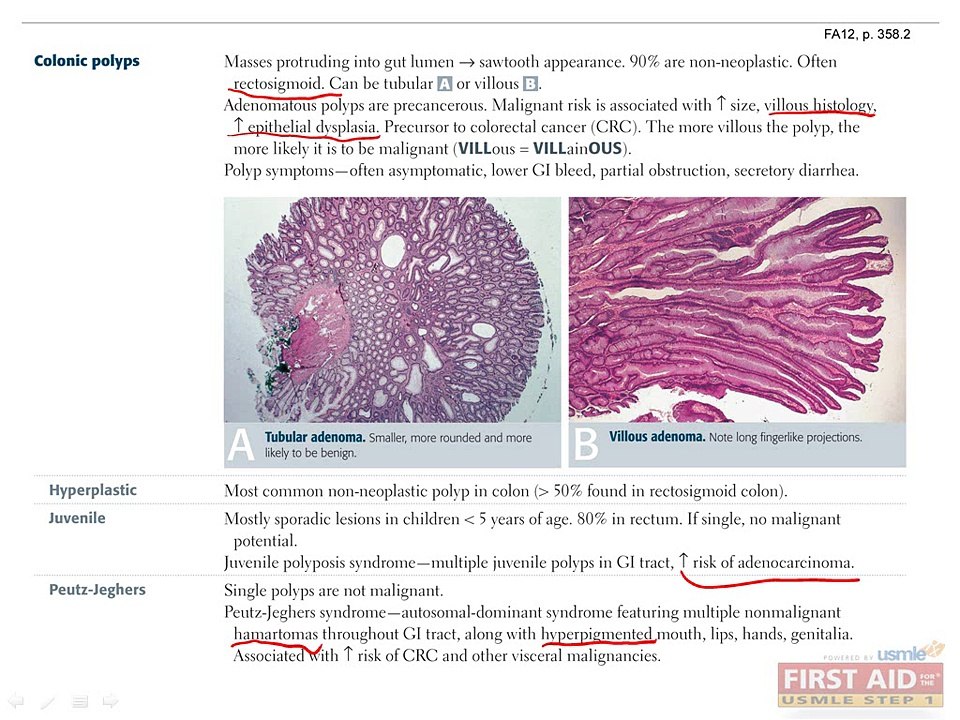 Gastrointestinal Pathology Part 4
