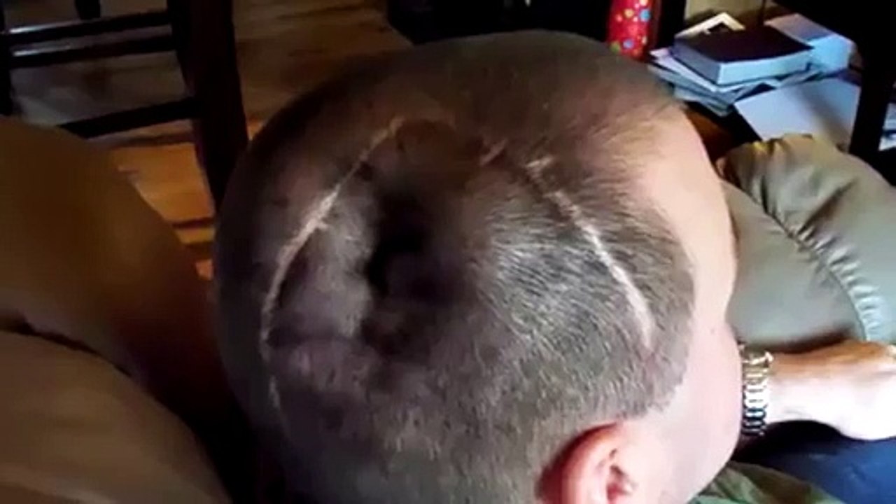 Cet homme est capable de gonfler son crâne comm...