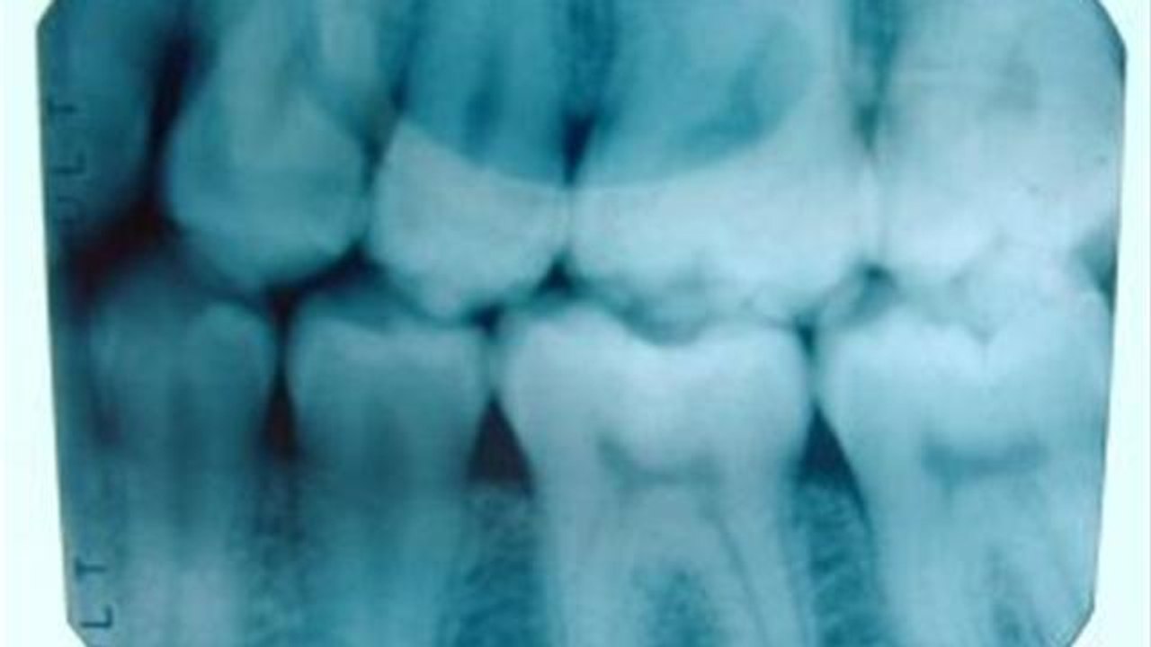 How to Lodge a Complaint about a Dentist