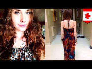 캐나다의 한 10대, 섹시한 옷으로 남학생들을 혼란스럽게 한다는 이유로 정학 당해