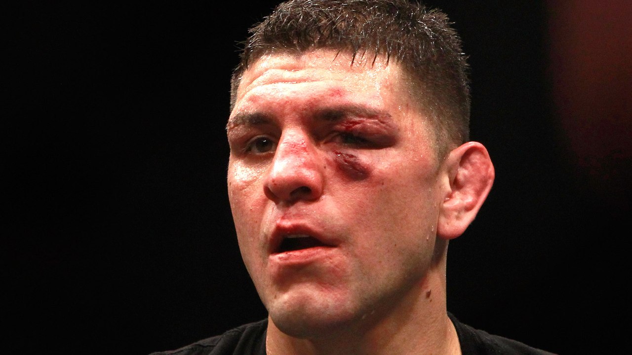 UFC Fighter Nick Diaz Gets Support From Wiz Khalifa & Cher