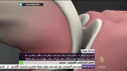 "خشونة مفاصل الركبة " هل هو مقترن بالتقدم في السن ؟ - ساعة صباح