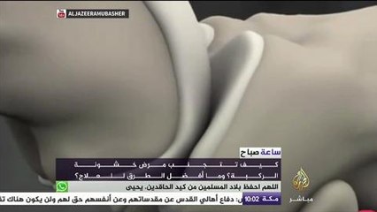 ساعة صباح … كيف تتجنب مرض خشونة الركبة؟