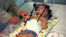 Doctors in Australia reattach toddler's head