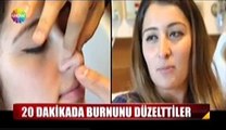 20 Dakikada Burun Ucu Estetiği!