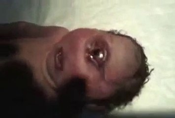 newly born baby with only one eye