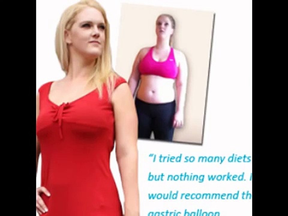 weight loss balloon
