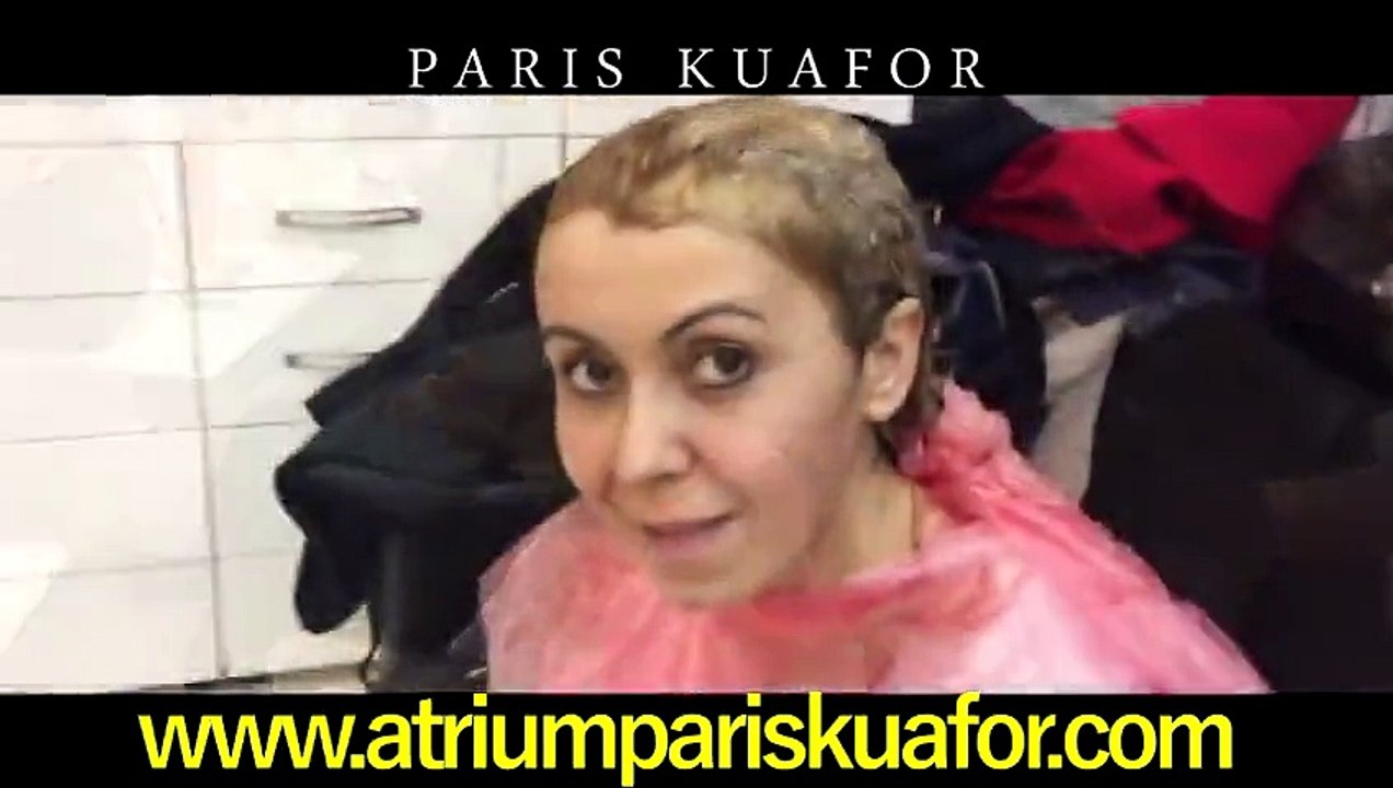 Saç Kaynak Videosu - Bülent Yılmaz