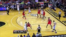 Joakim Noah Leg Injury - Bulls vs Nuggets - October 8, 2015 - 2015 NBA Preseason