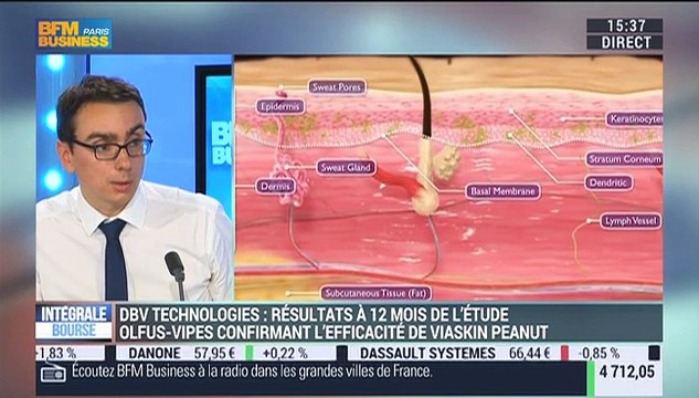 DBV Technologies a annoncé des résultats positifs sur son traitement contre l’allergie à l’arachide - 09/10