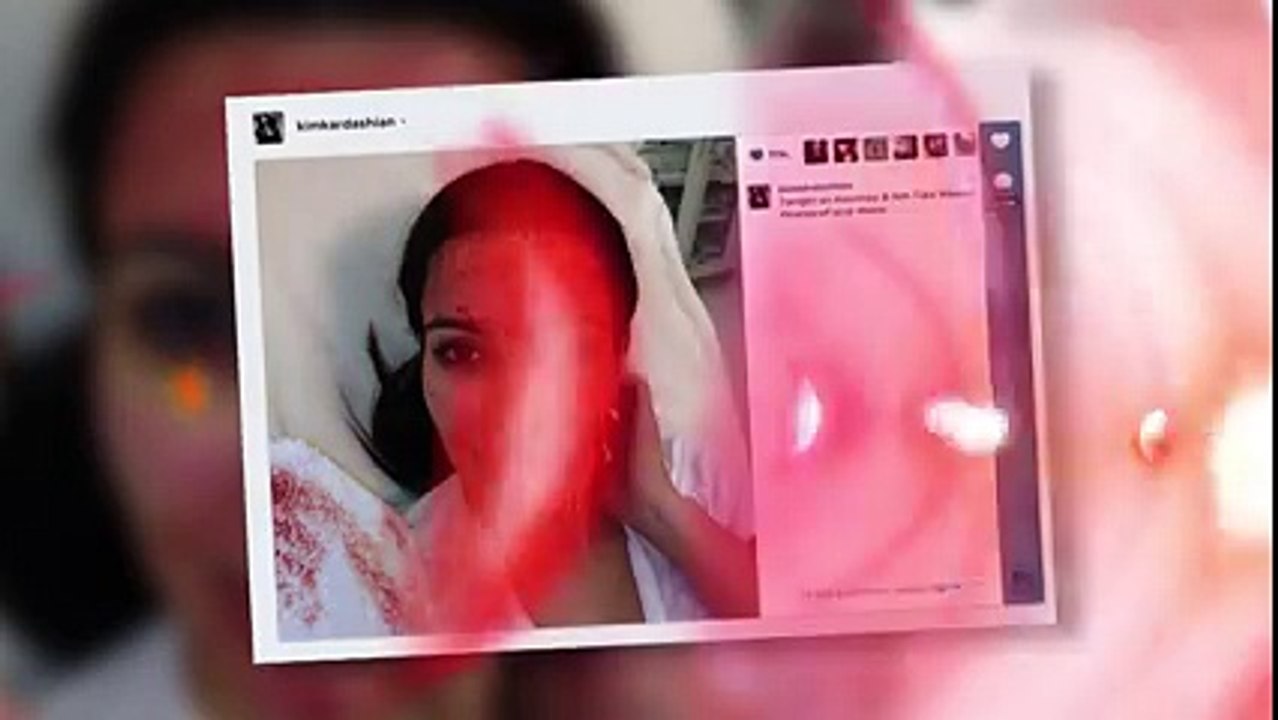 Kim Kardashian Tries Blood Facial After Kris Humphries’ Family Says By Oooy Idhar Dekh