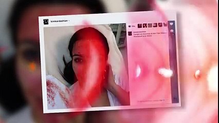 Kim Kardashian Tries Blood Facial After Kris Humphries’ Family Says By Oooy Idhar Dekh