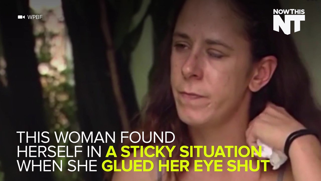 Woman Mistakes SuperGlue For Eye Drops, Glues Her Eye Shut video