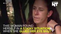 Woman Mistakes SuperGlue For Eye Drops, Glues Her Eye Shut
