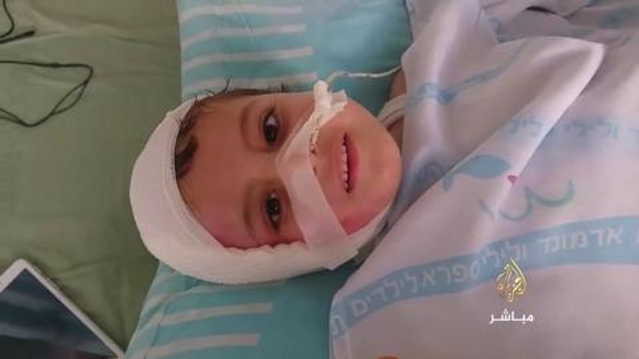 رغم الألم والجراح..تظل الابتسامة