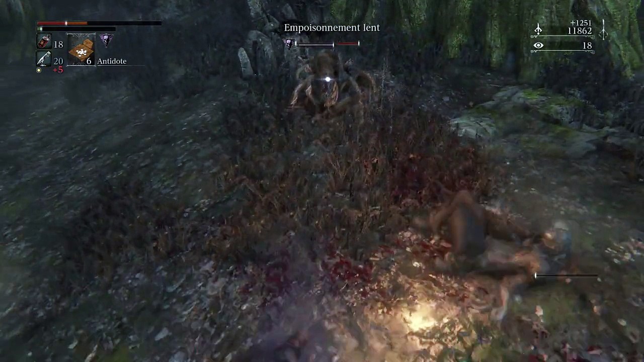 Bloodborne™_20151008142029