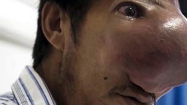 11 foto di persone che hanno un naso terribilmente gigante