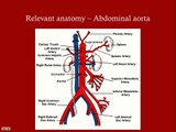 Carotid Artery Disease - CRASH! USMLE Step 2 and 3