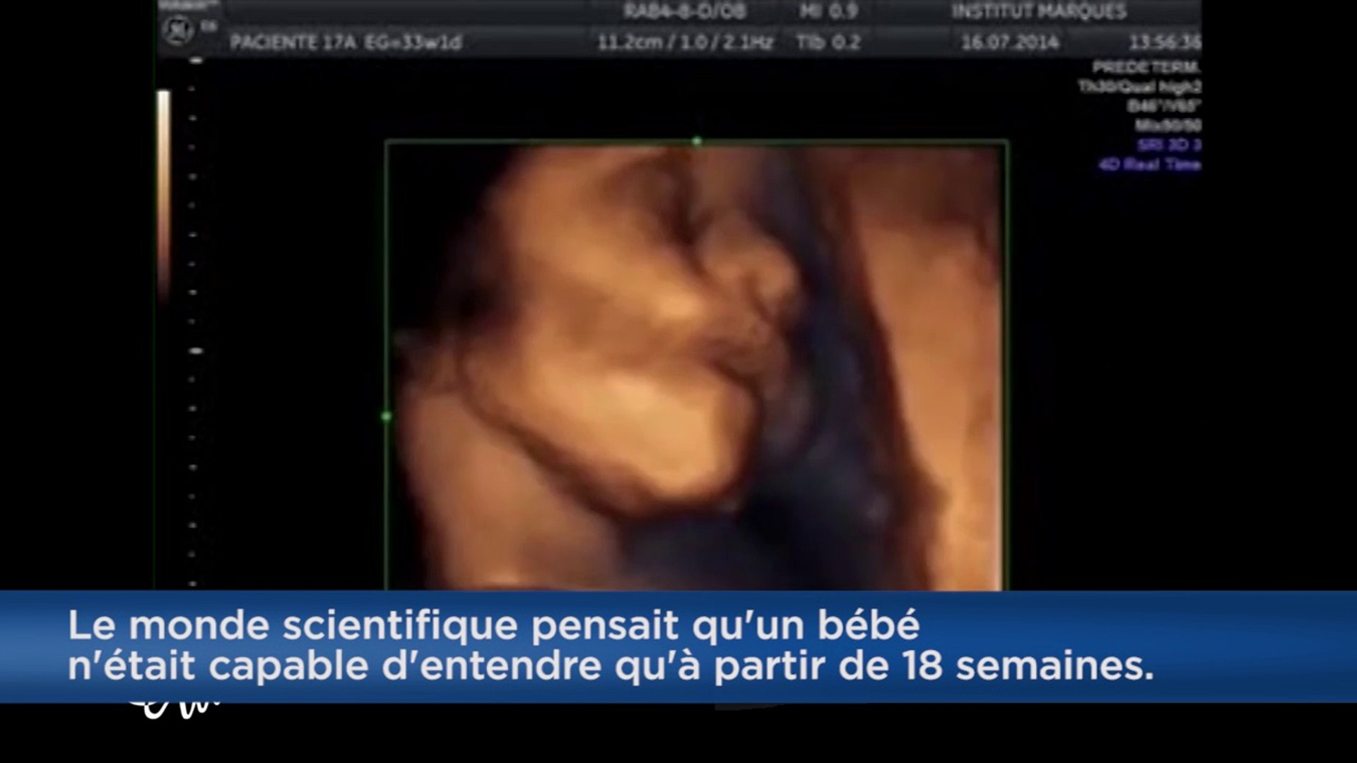 Un Bebe Chante Dans Le Ventre De Sa Mere En Entendant De La Musique Video Dailymotion