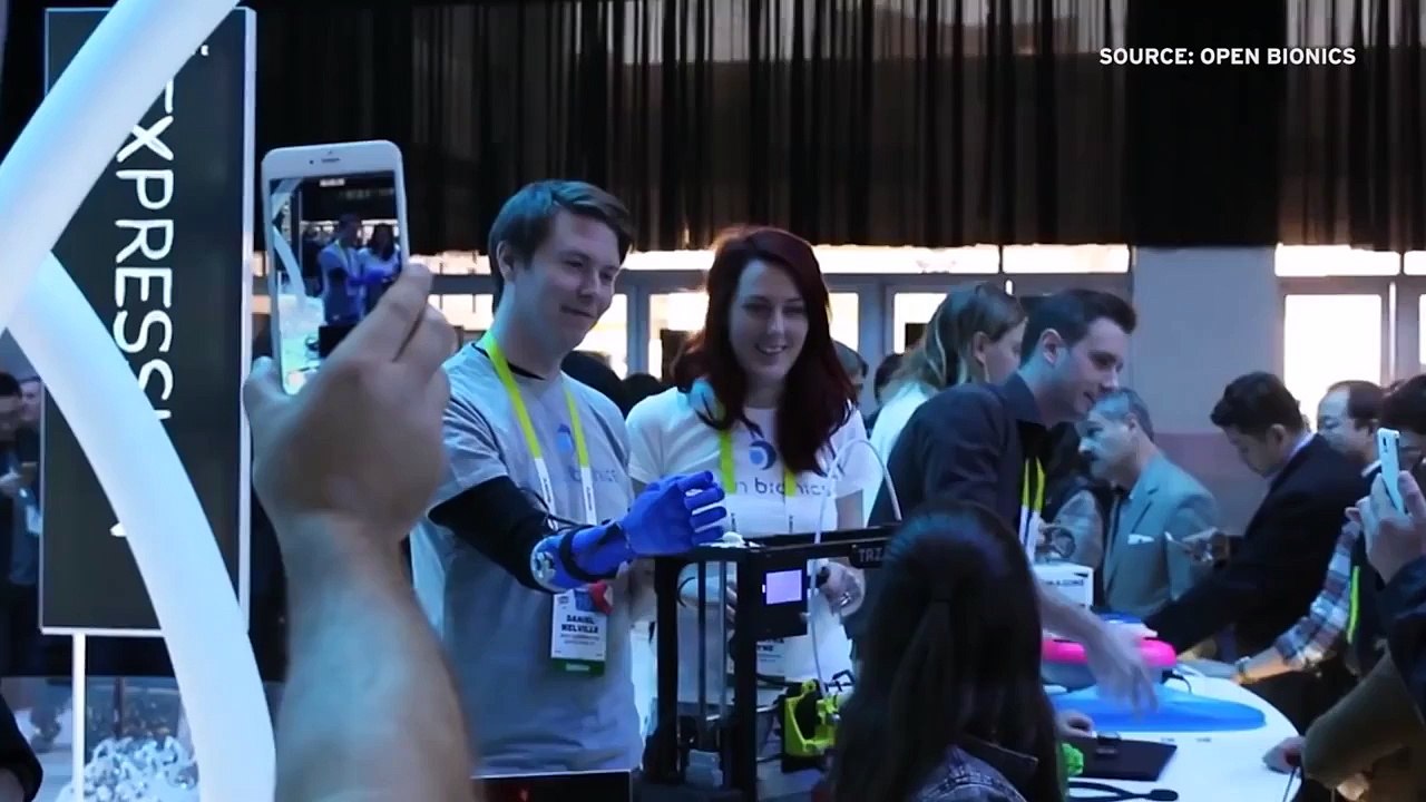 Open Bionics 3D Printed Robotic Hands