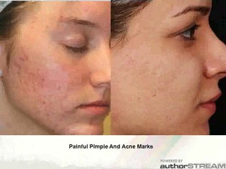 Fair and Clear Skin Tone With "Fair Look " Cream