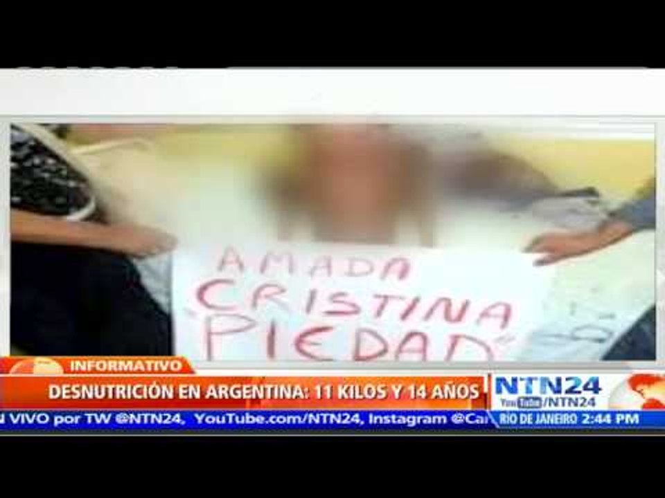 Caso de niño muerto por desnutrición despierta criticas en contra del Gobierno de Argentina