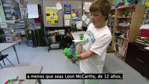 Leon Nació Sin Una Mano. No Creerás Lo Que Su Papá Hizo Para Él. Es De Otra Dimensión!