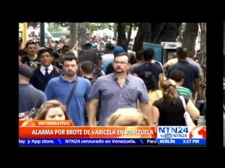 Alerta en Venezuela por posible epidemia de varicela, debido a escasez de la vacuna