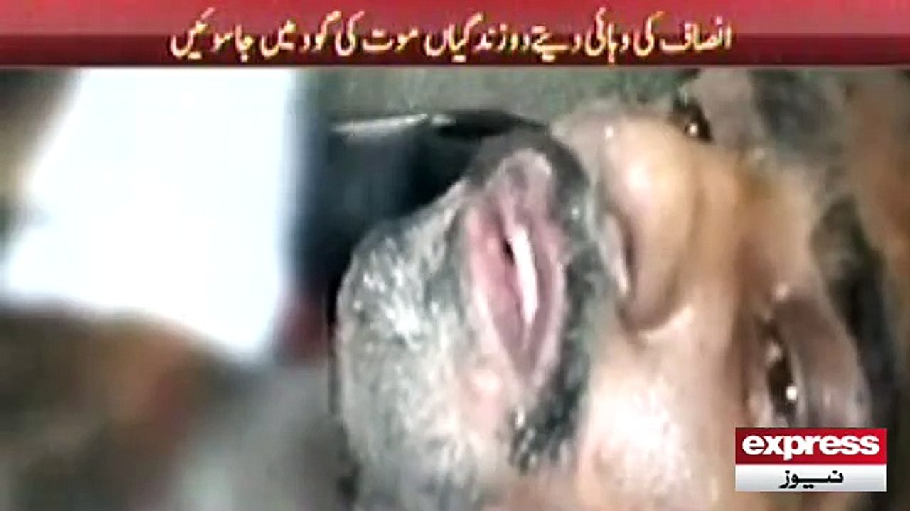 Shehbaz Burned