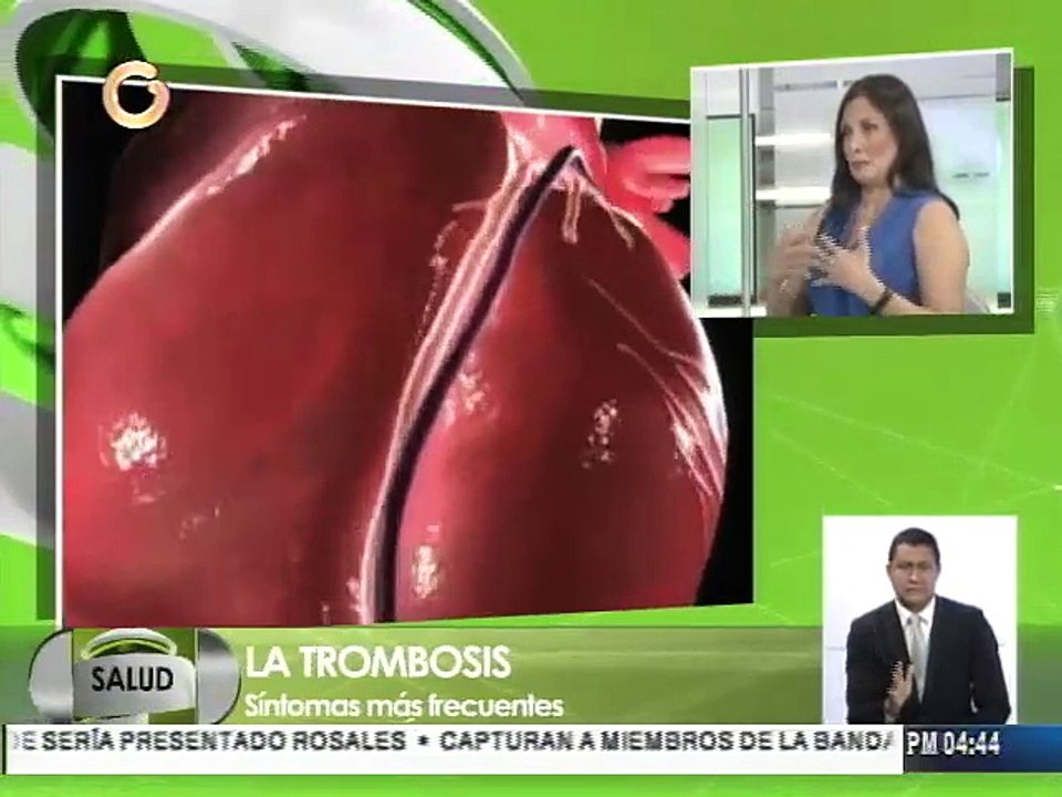 Durán: Los síntomas de esta enfermedad son: inflamación, enrojecimiento y dolencia en las piernas