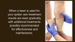 Spider Veins Treatment Chicago - Veins Without Surgery