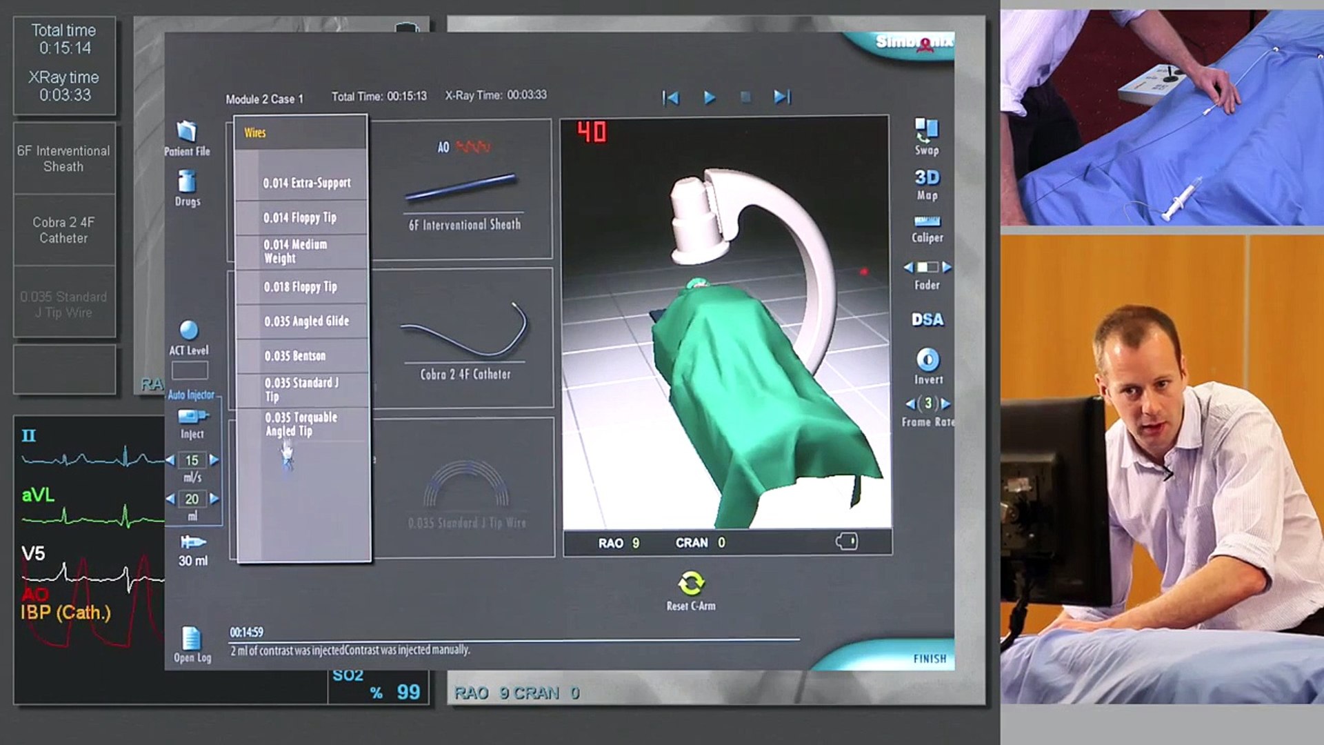 ⁣Popular Renal artery & Angioplasty videos
