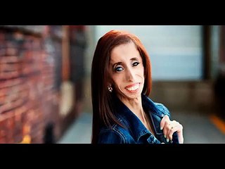 Valeria Levitin, a mulher mais magra do mundo.