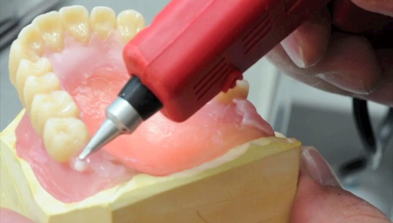 Jetwax Dental processus 05