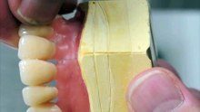 Jetwax Dental processus 02