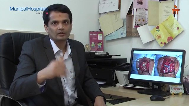 Foot Deformity in Childrens | Spine Fusion Surgery | Ankle Pain | Orthopaedic Care | Manipal