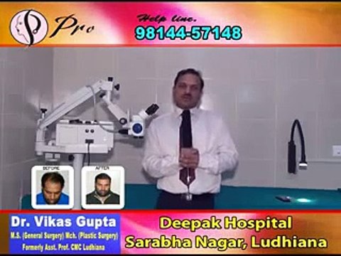 Hair Transplantation in India Punjab Ludhiana